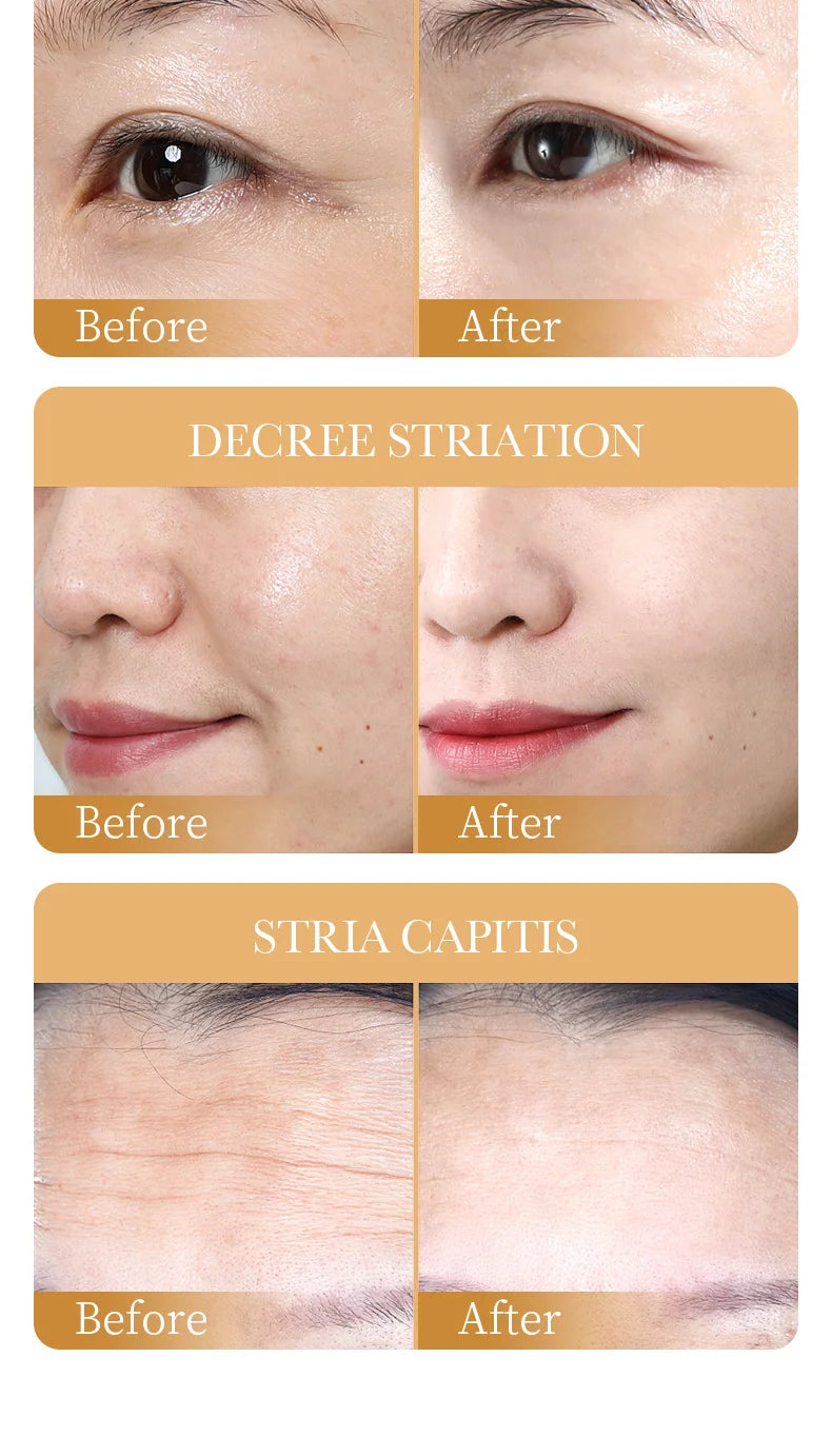 Collagen Anti-Wrinkle Face Mask (10pcs)
